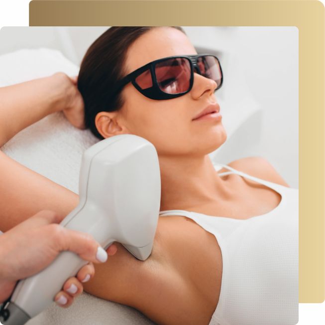 curso epilação a laser